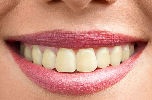 whitening1 whitening1