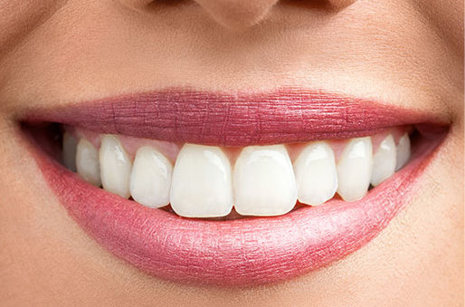 whitening2